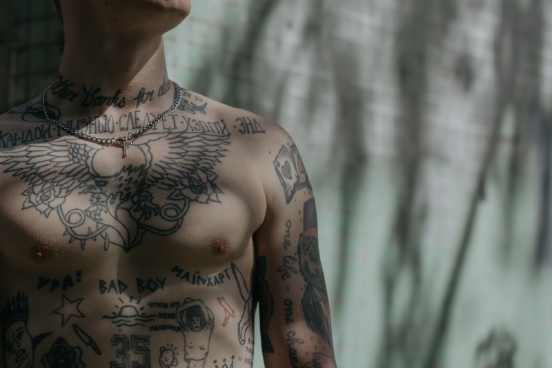 Odstranění tetování – „před a po“ aneb co byste měli vědět o přípravě, o samotném zákroku i následné péči