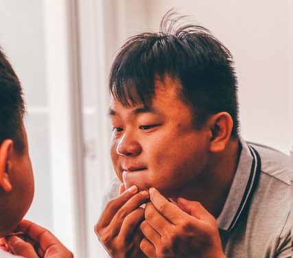 Proč trpíme akné a jak na něj vyzrát?