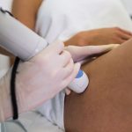 Laserová epilace a Olala studio.cz Vážně bude účinná?